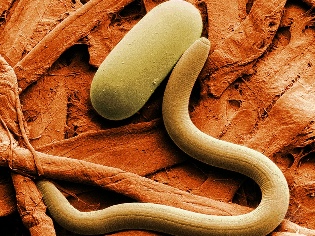 Signs of the presence of parasites in the human body