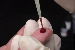 Blood test for helminths