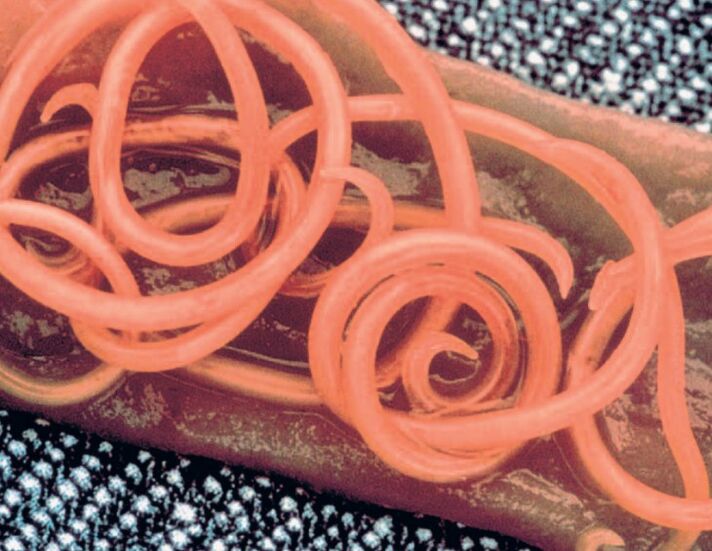 tapeworms from the human body