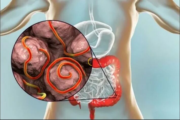 Parasites in human organism